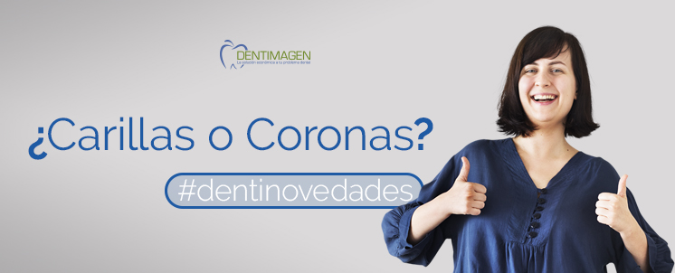 carillas o coronas dentales