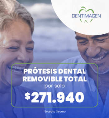 carrusel-protesis-dental-enero