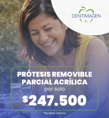 carrusel-protesis-remobible-enero