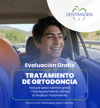 carrusel-tratamiento-ortodoncia-enero