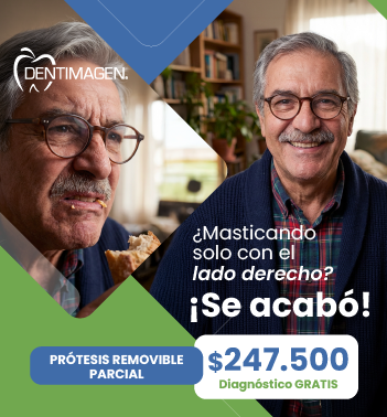 350x378 PROTESIS REMOBIBLE PARCIAL